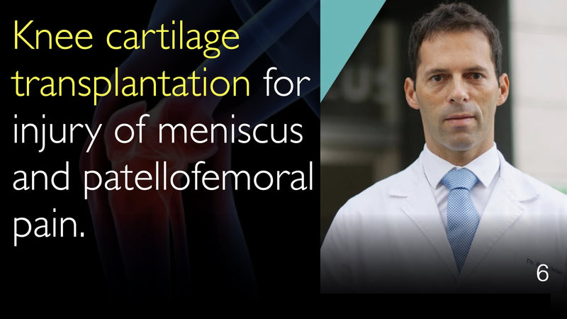 Kniekraakbeentransplantatie voor letsel van meniscus. Kraakbeentransplantatie voor patellofemorale pijn. 6